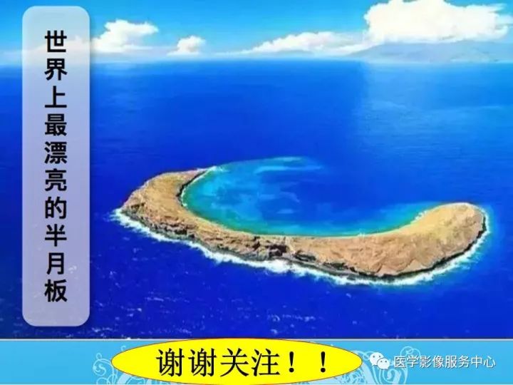 【PPT】一例漏诊腰部CT病例(转移瘤)的启示