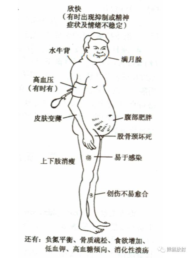 一图秒懂丨非医源性皮质醇增多症之各类肾上腺病变的表现