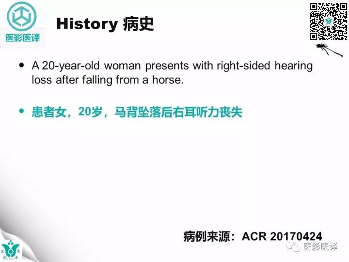 【病例】累及听软骨囊的颞骨骨折1例CT