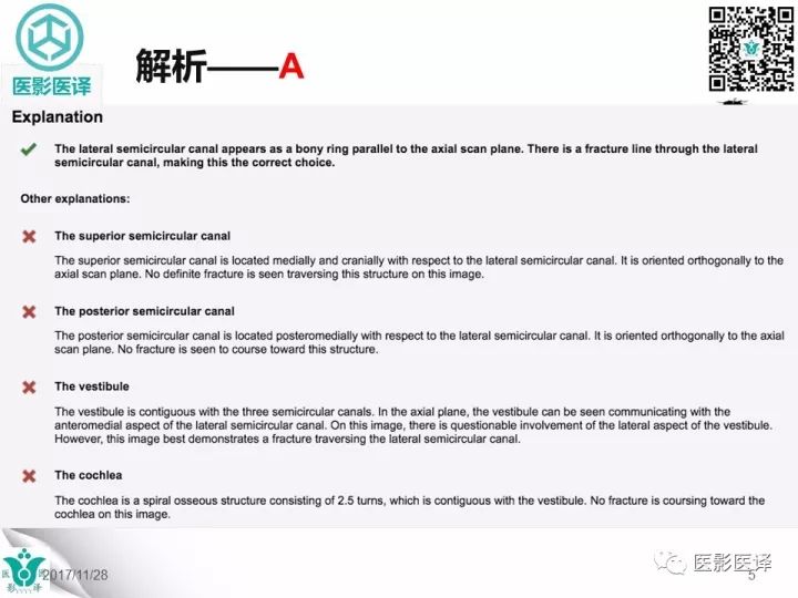 【病例】累及听软骨囊的颞骨骨折1例CT