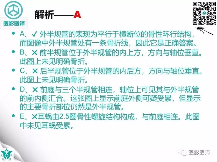 【病例】累及听软骨囊的颞骨骨折1例CT