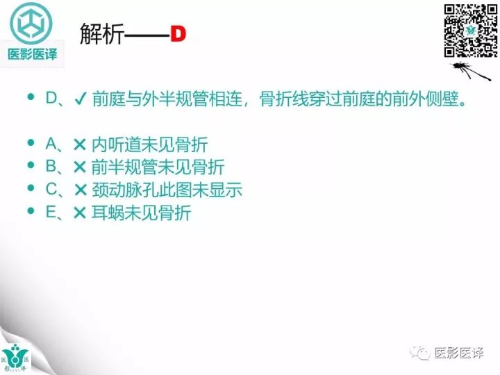 【病例】累及听软骨囊的颞骨骨折1例CT