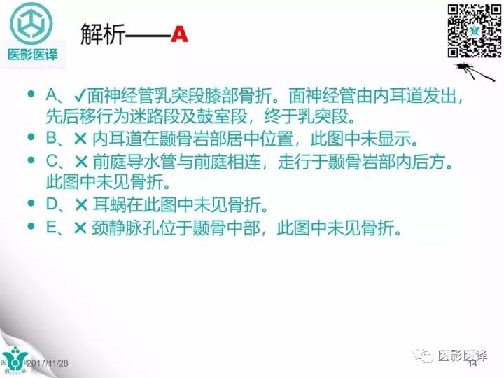【病例】累及听软骨囊的颞骨骨折1例CT