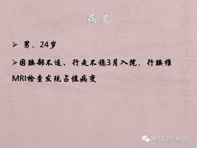 【病例】脊髓腰骶段粘液乳头型室管膜瘤1例MR