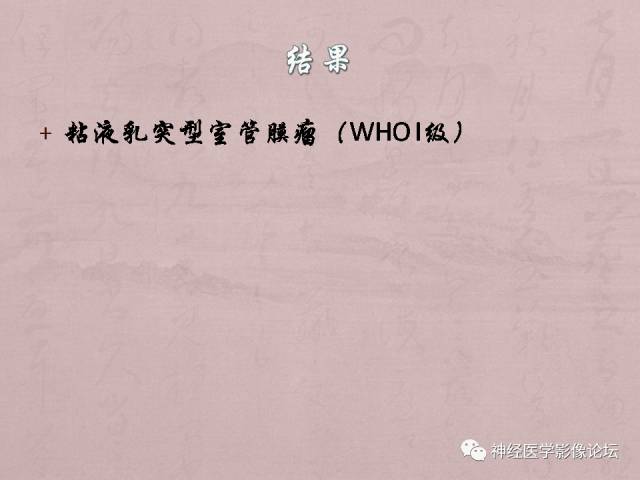 【病例】脊髓腰骶段粘液乳头型室管膜瘤1例MR