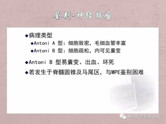 【病例】脊髓腰骶段粘液乳头型室管膜瘤1例MR