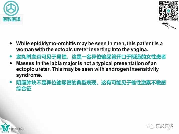 【病例】肾盂输尿管重复畸形伴异位输尿管开口于阴道壁1例CT