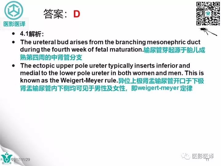 【病例】肾盂输尿管重复畸形伴异位输尿管开口于阴道壁1例CT