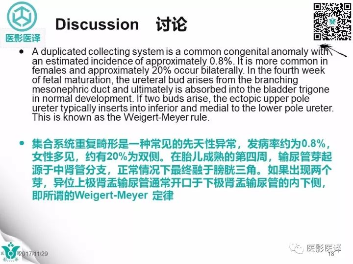 【病例】肾盂输尿管重复畸形伴异位输尿管开口于阴道壁1例CT