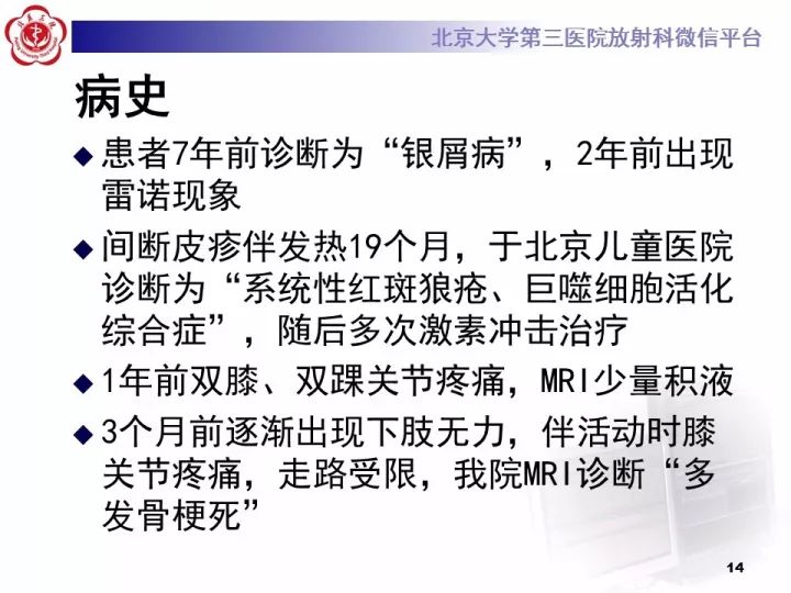 【病例】骨梗死1例MR影像诊断