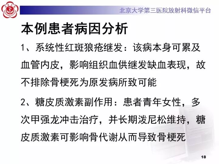 【病例】骨梗死1例MR影像诊断