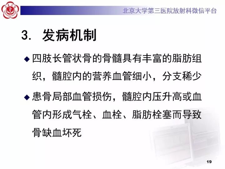 【病例】骨梗死1例MR影像诊断