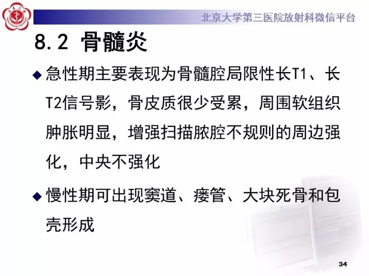【病例】骨梗死1例MR影像诊断