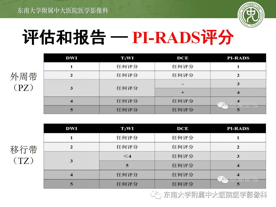 【病例】前列腺癌VS前列腺增生结节VS前列腺脓肿4例MR 【病例】前列腺癌VS前列腺增生结节VS前列腺脓肿4例MR