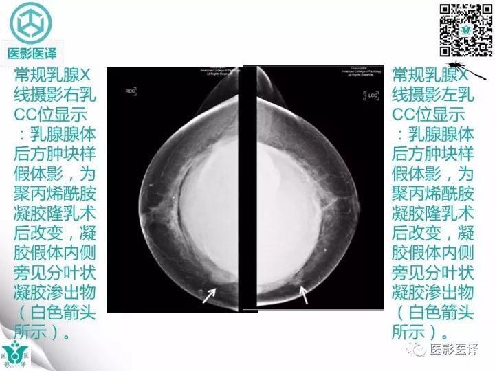 【病例】