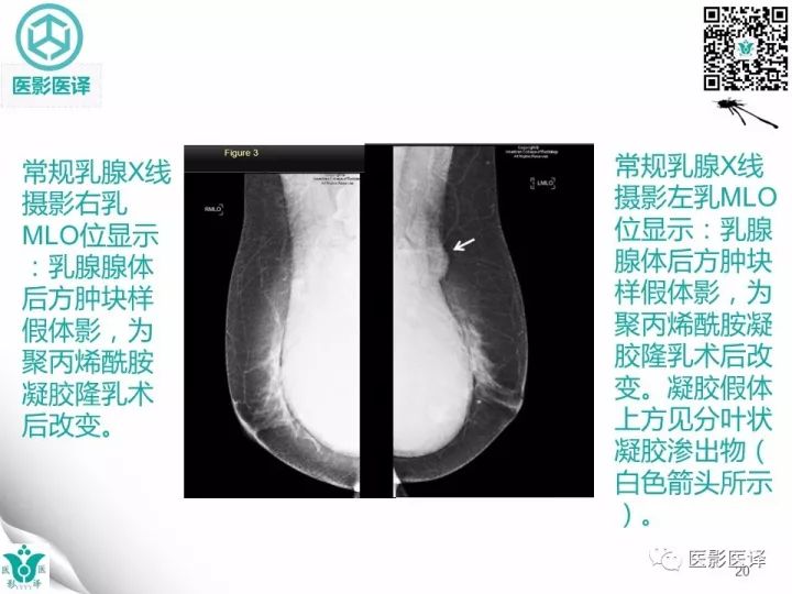 【病例】