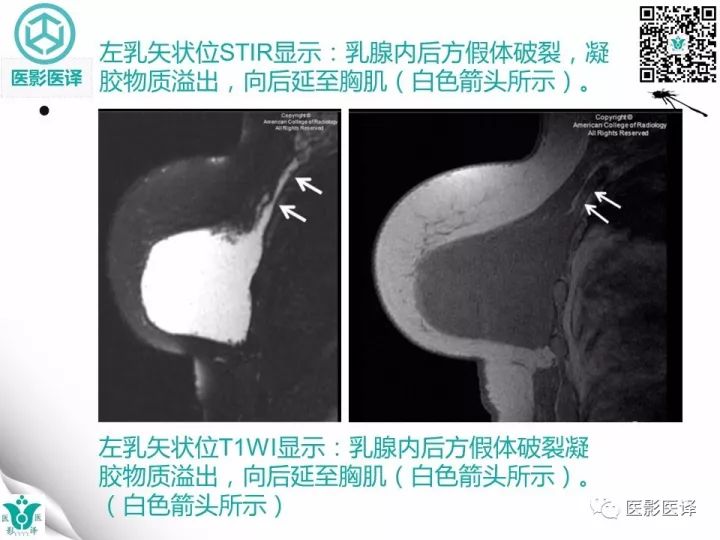 【病例】