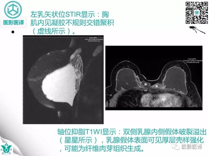 【病例】