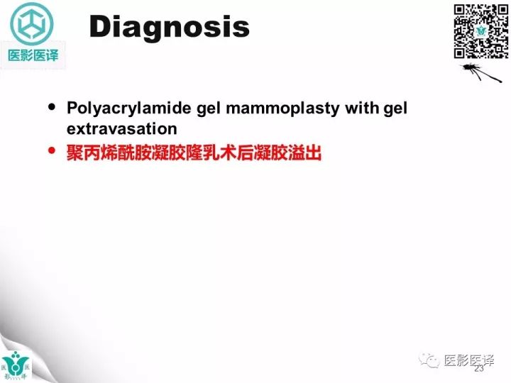 【病例】