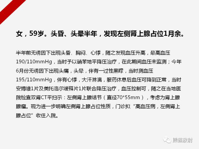 【病例】肾上腺嗜铬细胞瘤1例CT影像表现