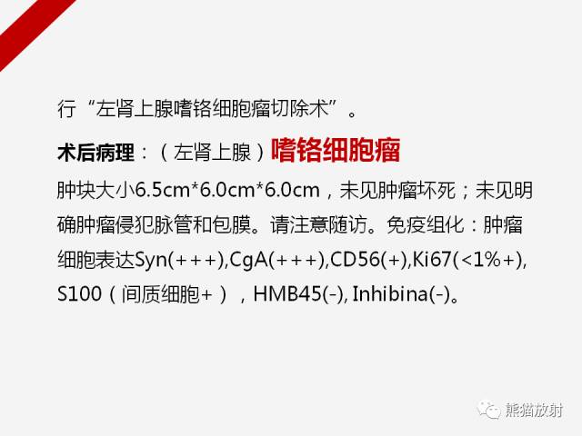 【病例】肾上腺嗜铬细胞瘤1例CT影像表现