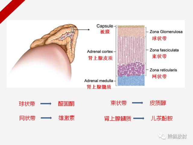 【病例】肾上腺嗜铬细胞瘤1例CT影像表现