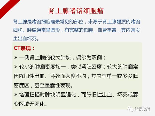 【病例】肾上腺嗜铬细胞瘤1例CT影像表现