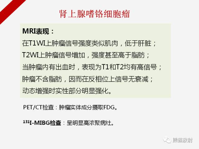 【病例】肾上腺嗜铬细胞瘤1例CT影像表现