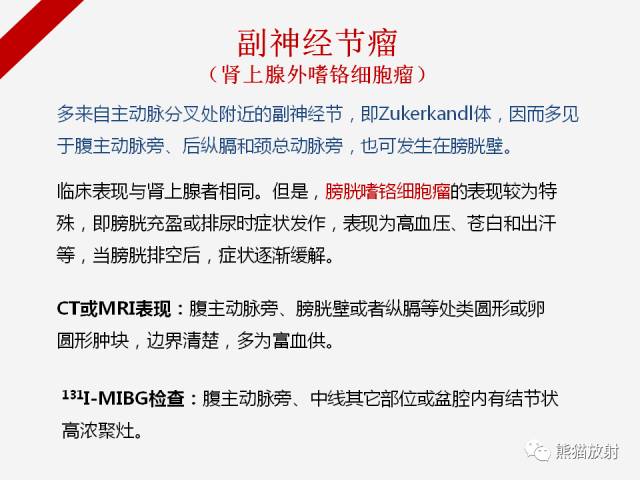 【病例】肾上腺嗜铬细胞瘤1例CT影像表现