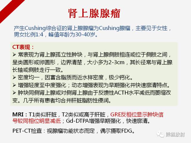 【病例】肾上腺嗜铬细胞瘤1例CT影像表现