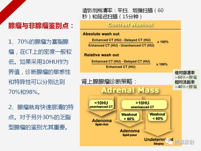 【病例】肾上腺嗜铬细胞瘤1例CT影像表现