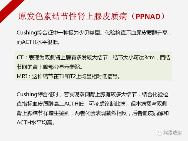 【病例】肾上腺嗜铬细胞瘤1例CT影像表现