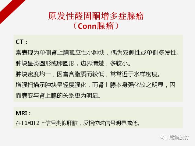 【病例】肾上腺嗜铬细胞瘤1例CT影像表现