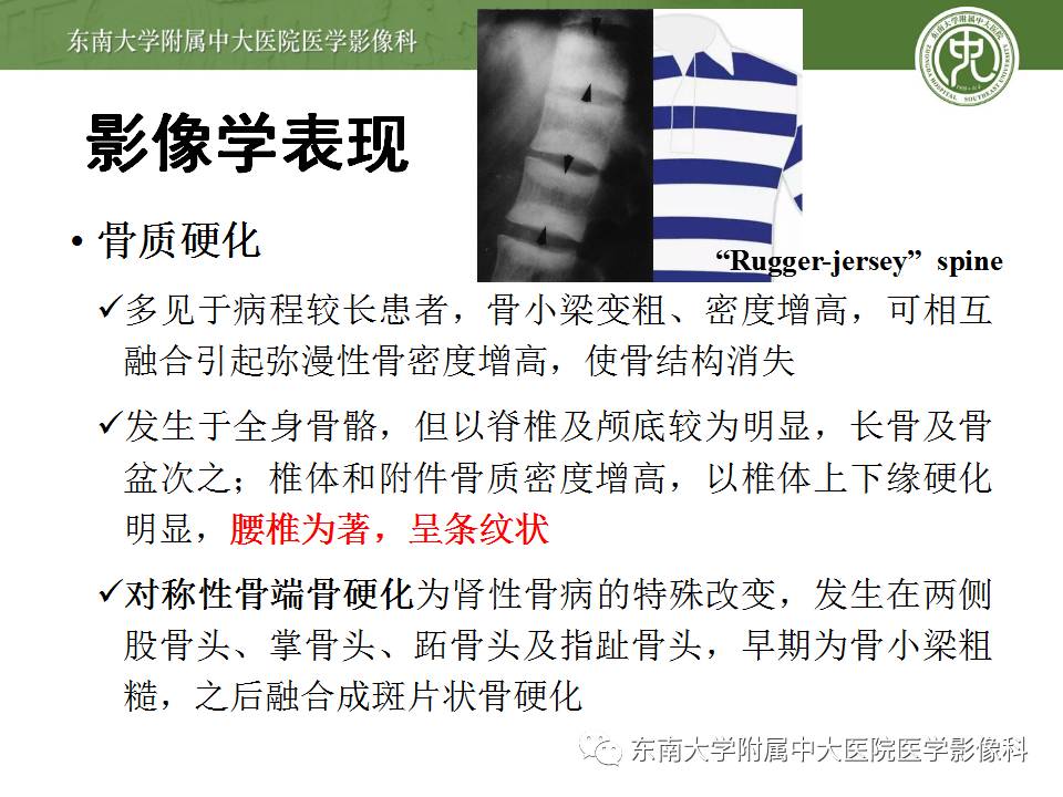 【病例】肾性骨病/肾性骨营养不良1例CT影像表现 【病例】肾性骨病/肾性骨营养不良1例CT影像表现