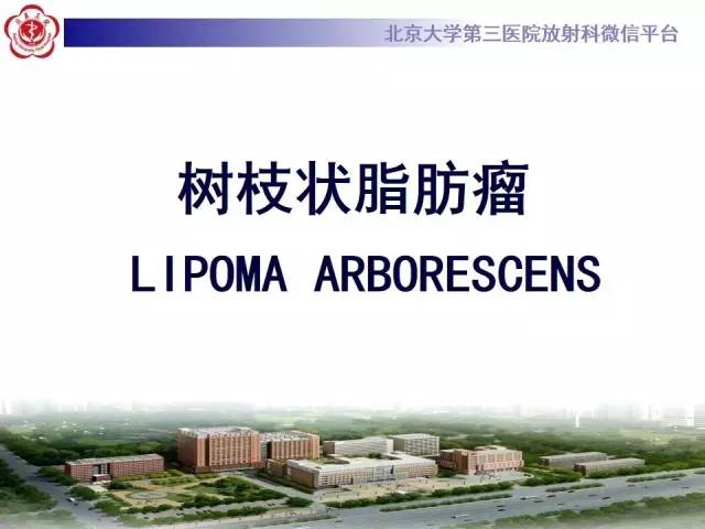 【病例】膝关节树枝状脂肪瘤1例MR影像表现