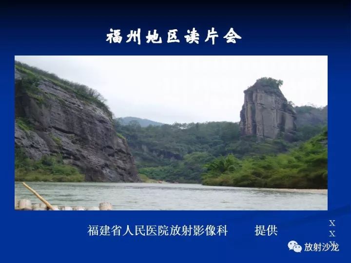 【病例】肝囊肿伴液化坏死部分出血1例MR