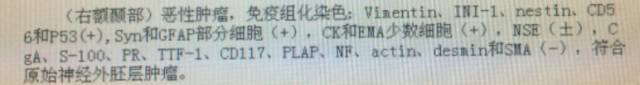 【病例】右额颞叶PNET一例MR 【病例】右额颞叶PNET一例MR
