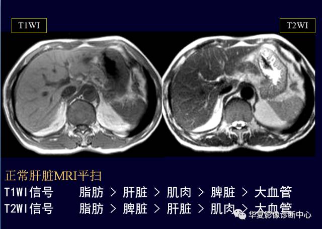 【PPT】非占位性肝病变MRI诊断