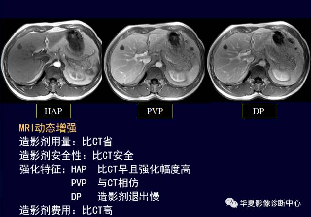 【PPT】非占位性肝病变MRI诊断