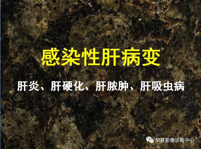【PPT】非占位性肝病变MRI诊断