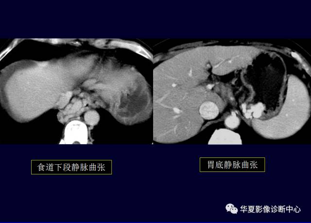 【PPT】非占位性肝病变MRI诊断