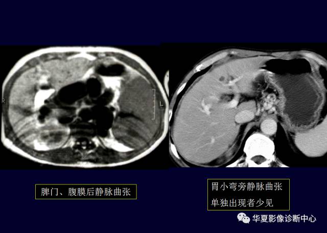 【PPT】非占位性肝病变MRI诊断
