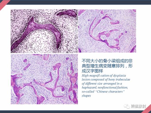 【PPT】骨肿瘤样病变——从病理到影像