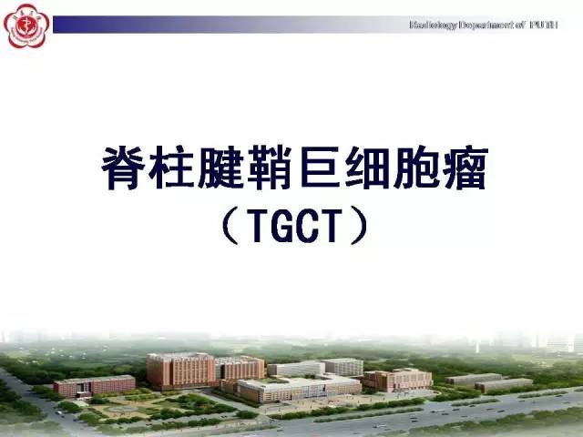 【病例】颈椎腱鞘巨细胞瘤1例CT及MR影像诊断
