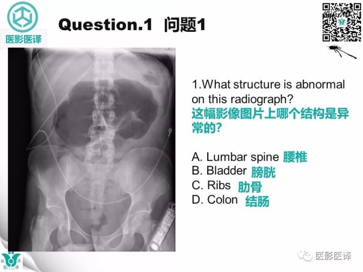 【病例】盲肠扭转伴幽门梗阻1例X线CT影像表现