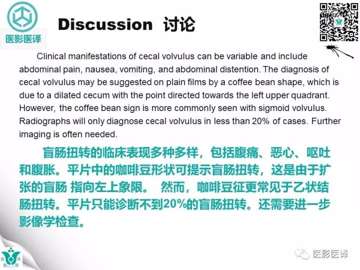 【病例】盲肠扭转伴幽门梗阻1例X线CT影像表现