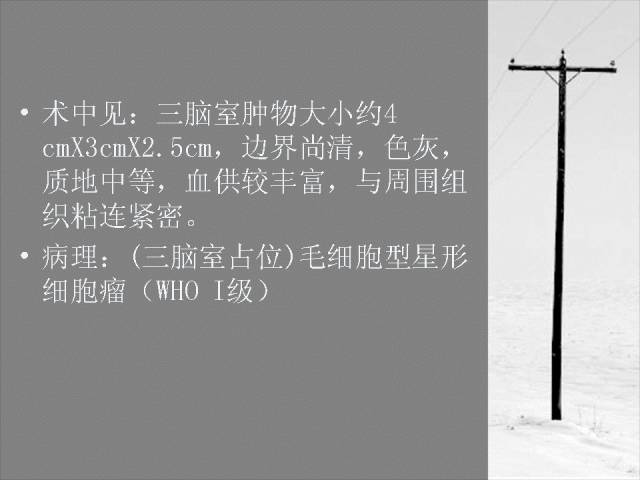 【病例】三脑室毛细胞型星形细胞瘤一例CT及MR