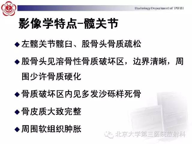 【病例】骨关节结核1例X线CT及MR一例影像表现