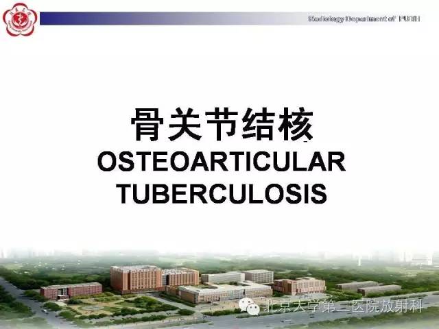 【病例】骨关节结核1例X线CT及MR一例影像表现