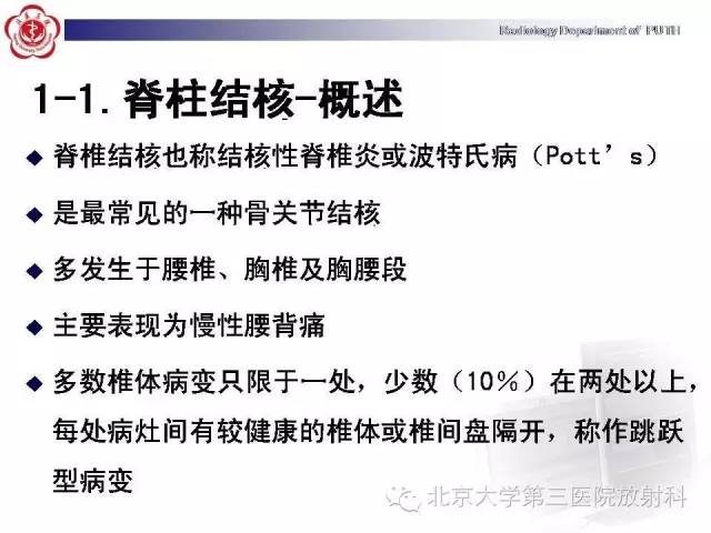 【病例】骨关节结核1例X线CT及MR一例影像表现